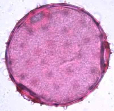 (µm) Class Aperture Types Acacia nilotica AM 35 x
