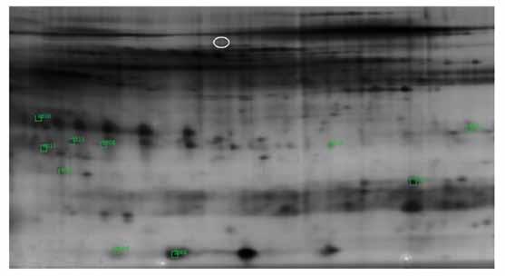 # Liver specific glycoforms of serum proteins # size. The gel images were subsequently analysed with the image analysis software PDQuest (Bio-rad). The samples were profiled in duplicate.