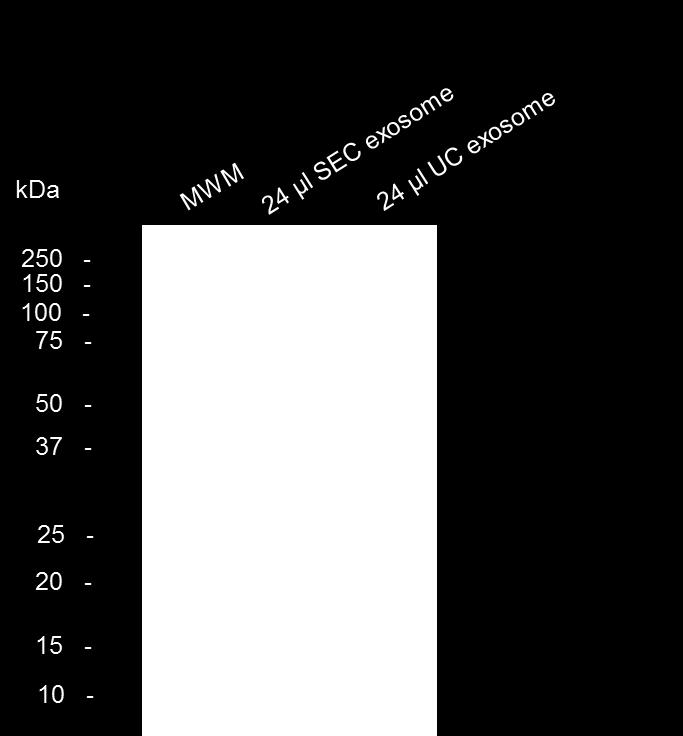 Absorbance (280 nm) 1. Exosome isolation 1.1 Size exclusion chromatography (SEC) 1.2 Ultracentrifugation (UC) 1.6 1.4 1.2 1 0.8 0.6 0.4 0.