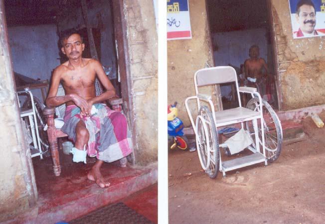 Amputee father / breadwinner Priyantha /had worked as a vegetable Seller / 37 years /,married with 5 children eldest 8 years, youngest 4 months Right Below Knee Amputation + right forearm fracture