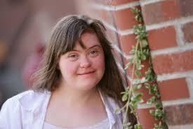 Ageing & Down syndrome Ageing impacts on people with Down syndrome at an earlier age, and