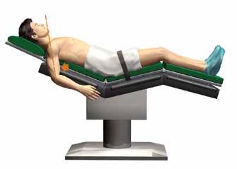 Patient positioning The patient is placed in a semi-sitting (beach chair) position, inclined approximately 30 or more.