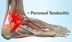 Tendons are thick cords of tissue that connect muscles to bone.