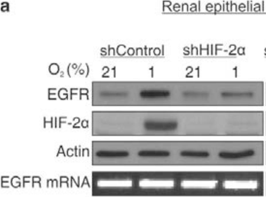 EGFR levels in hypoxic cells do not increase when HIF-2