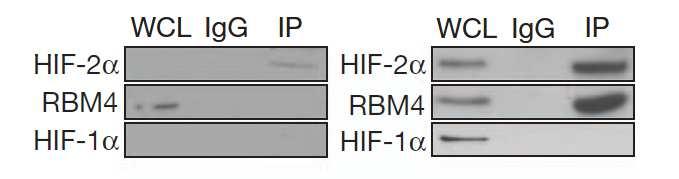 RNA-binding protein RBM4 recruits HIF-2alpha in hypoxia Co-immunoprecipitation of HIF-2a 21% O2 1%O2 Co-immunoprecipitation of