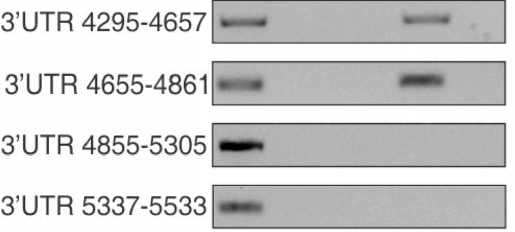 RT-PCR using primers within the 5 UTR and 3 UTR of EGFR mrna.