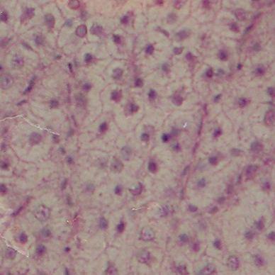 Slightly irregularly arranged hepatocytes with glycogen deposition are seen