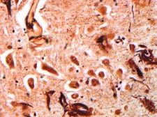 Neuropathology The Neuropathology consultative group specializes in the pathological evaluation and interpretation of patient specimens from the central and peripheral nervous systems and skeletal
