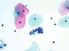 Cytopathology Cleveland Clinic s Cytopathology laboratory evaluates more than 65,000 gynecologic and 22,000 non-gynecologic specimens and has expertise in diagnosing a wide breadth of disease