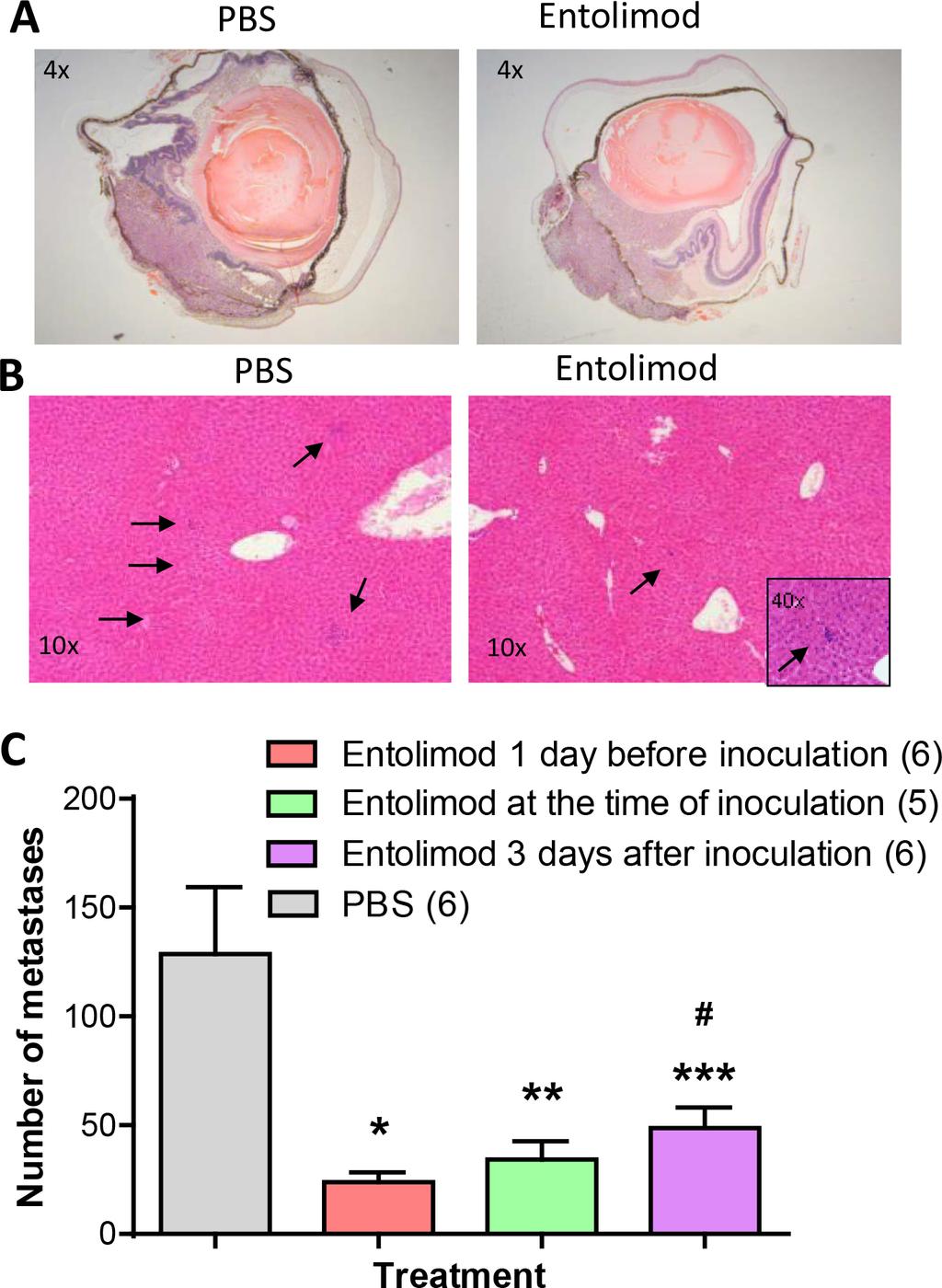 Figure 1: Effect of entolimod treatment on liver metastasis of B16LS9 UM tumors following enucleation of the tumor-bearing eye.