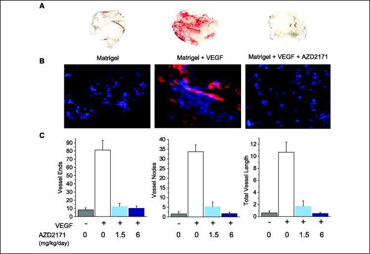 AZD2171 inhibits VEGF-induced angiogenesis in vivo. Wedge S R et al.