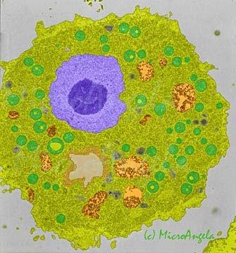 Macrophage means "big eater". Macrophages are white blood cells that crawl around in the extracellular fluids of your body and gobble up microbes and other foreign material.