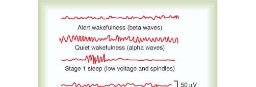Interpretation of EEG Waves EEG Waves in Sleep Beta waves: frequency range from 13-15 to 60 Hz, amplitude of about 30 μv.