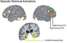 Episodic vs Semantic Memory Semantic Memory Semantic memory is for facts, while episodic memory