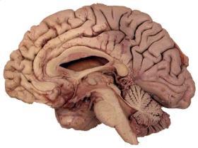 Brainstem (hindbrain) Brainstem (hindbrain) Description- Stem like