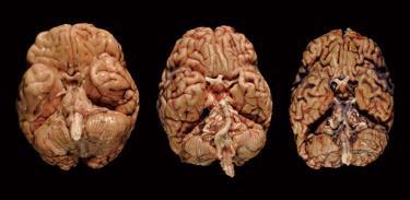 of the brain perform different functions: Broken Brain