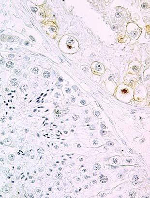 ) Primary magnification: a 20;b c 40 a b c Fig..49a c. Testicular histology. a Seminiferous tubules showing intact spermatogenesis.