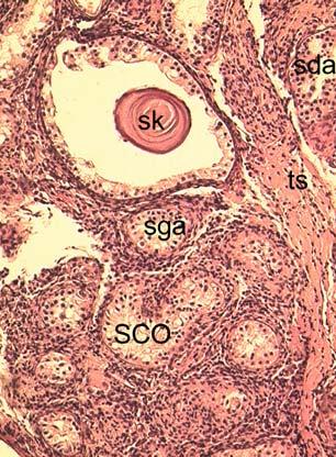 to nuclei of normal Sertoli cells (inset = magnification of rectangle a).