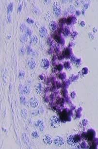 Paraffin section, haematoxylin counterstaining; primary magnification: 40.