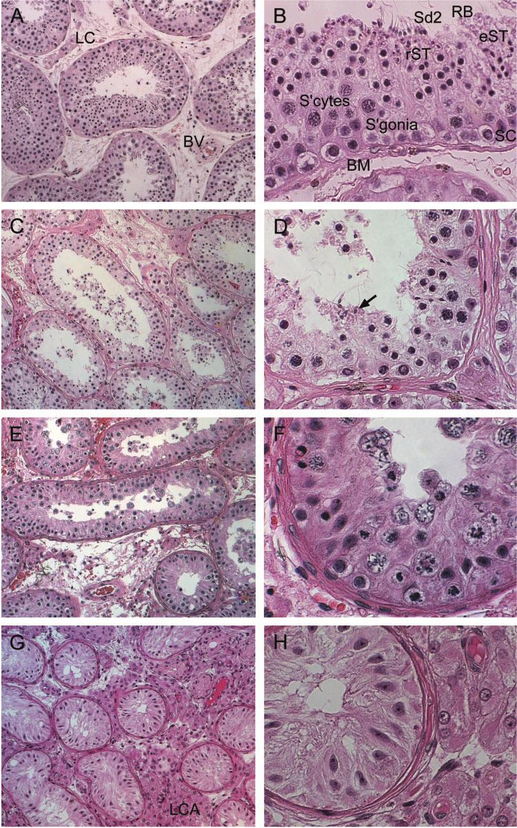 R.I.McLachlan et al. Figure 2. Pure spermatogenic phenotypes. Normal spermatogenesis (A, 10; B, 40).