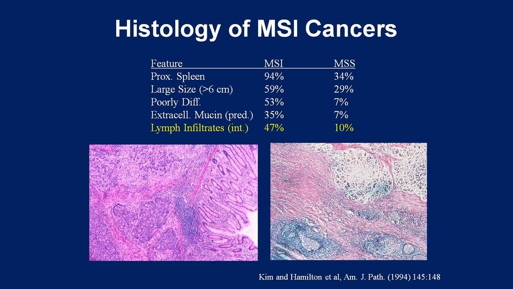 Histology of MSI Cancers Presented By Luis