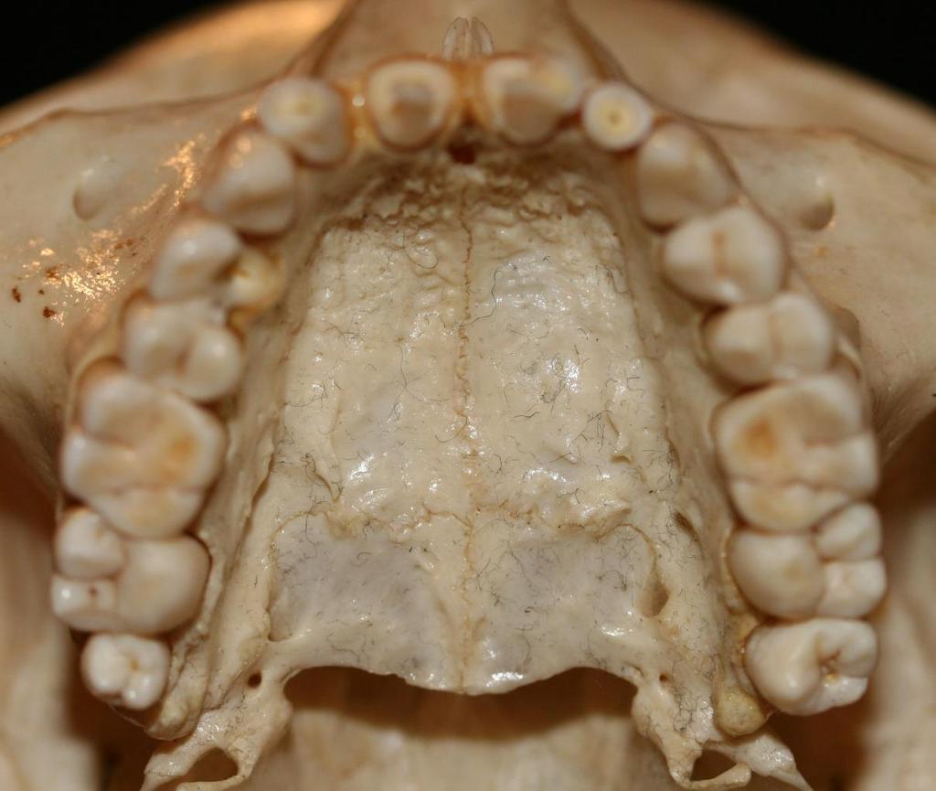 Functional Anatomy Maxilla Two maxillary