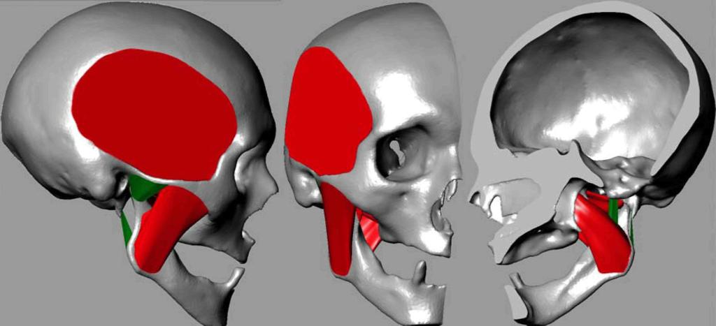 Modelling of temporomandibular joint and FEM analysis 37 Fig. 1. The geometrical model of skull and mandible 2.