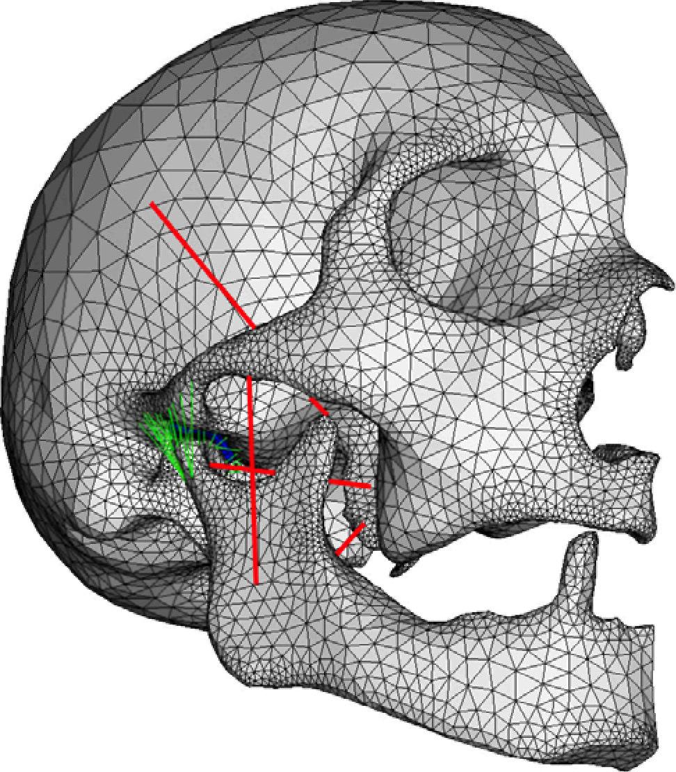 The TM disc was meshed by eight-noded brick elements in the TrueGrid mesh program. Finally, muscles and ligaments were defined by connector elements.