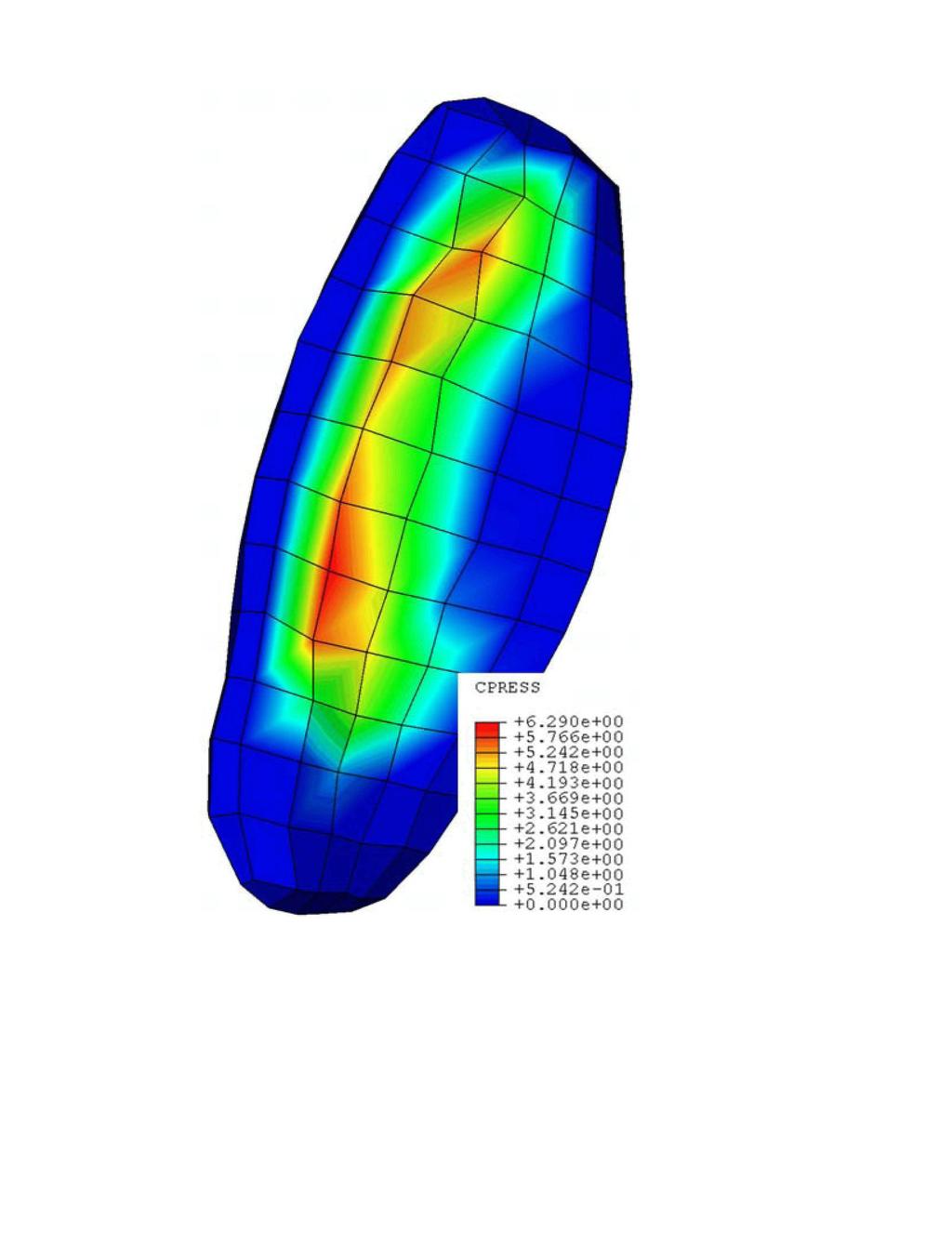 Modelling of temporomandibular joint and FEM analysis 41 Fig. 5. Distribution of the von Mises stresses in the mandible [MPa] Fig. 6.