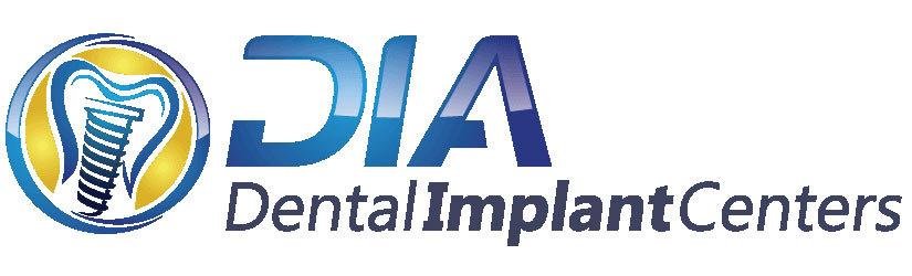 Full Mouth Dental Implant Restoration Buyer s Guide Summary If your teeth are failing due to gum disease, cavities, trauma, or are simply breaking down from years of active use, the All-On-4 dental