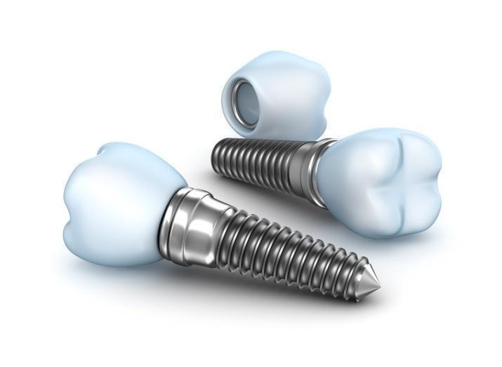 A dental implant performs the same function as the root of a tooth.