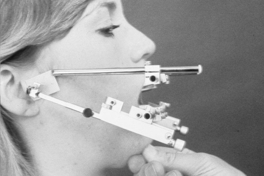 Fig. 4 Terminal Hinge Axis Location - Pantograph (Denar Corp.) A Kinematic Face-Bow, such as those illustrated above, uses an extra-oral device to locate the axis points on the face.