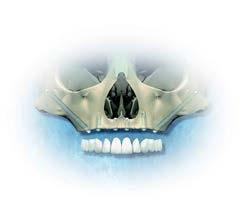6 Nobel Biocare Annual Report 2012 Our strategy Edentulous Fixed removable Fixed 12 million implants placed.