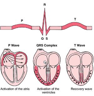 ECG Atrial contractions show up as the P wave. Ventricular contractions show as a series known as the QRS complex.