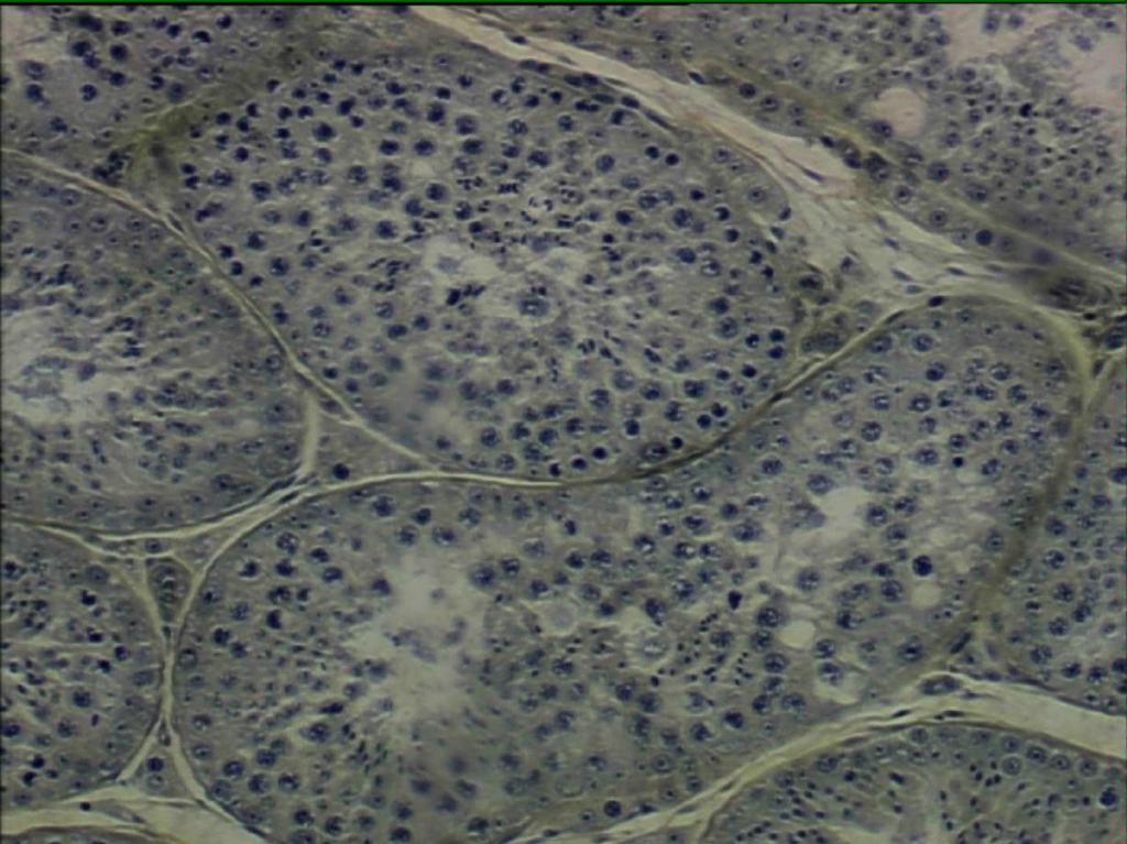 Histology of the Testes Interstitial cells of Leydig Interstitial endocrinocytes Located between seminiferous tubules