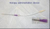 2. Administration Method: I-131 NaI Solution Patient is NPO from midnight until appointment time next day Long needle at end of a special therapy administration