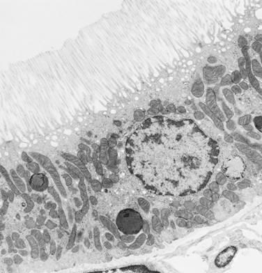 Proximal Convoluted Tubule Cuboidal (low to high) cells Eosinophilic granular cytoplasm Basal nuclei
