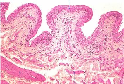 Urinary Bladder Mucosa - transitional