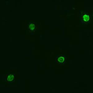 Antigen Detection of Malaria Malaria antigens used for these rapid diagnostic tests are histidine-rich protein 2 (HRP-