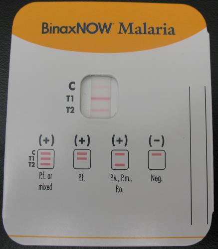 Antigen Detection of Malaria May be useful for: Field testing when microscopy is not available