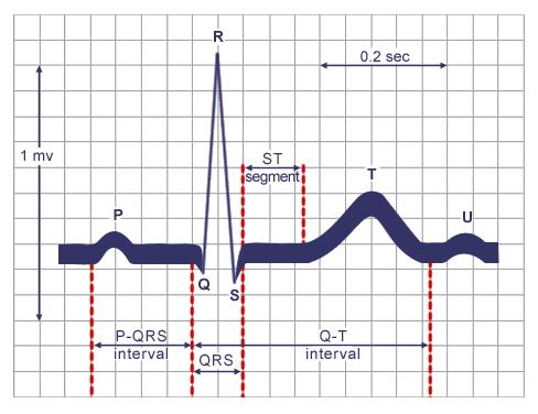 6 PQRSTU Summary: http://alexandria.healthlibrary.ca Indicates atrial depolarization, or contraction of the atrium Normal duration is not longer than 0.