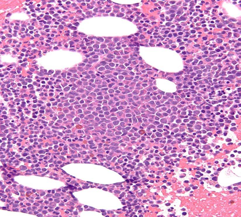 Mature plasmacytoid dendritic