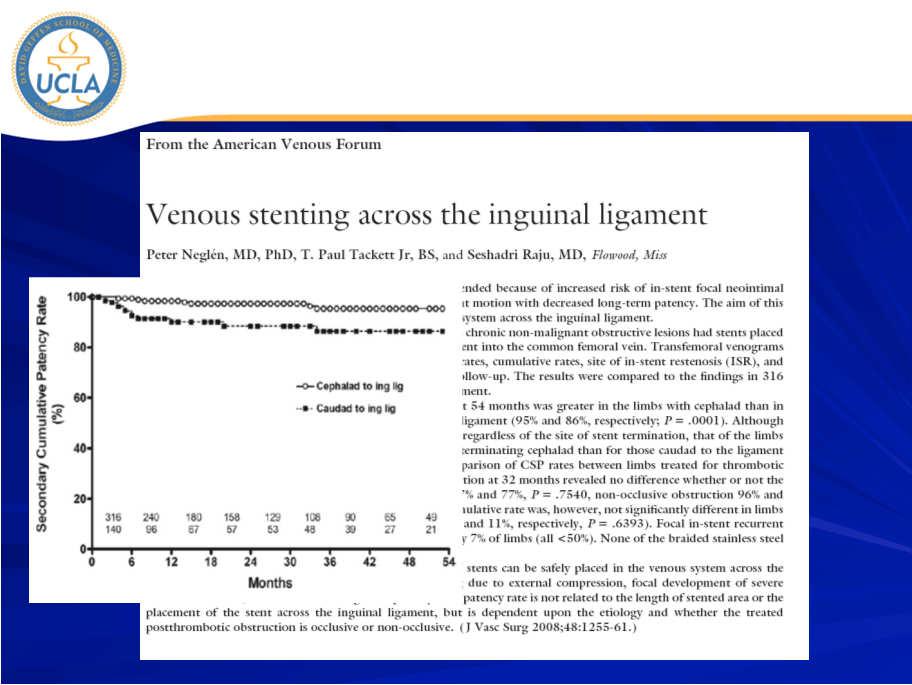 Stenting across Inguinal Ligament Stenting across Inguinal Ligament HIP STRAIGHT HIP FLEX 90