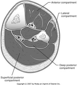 Superficial Posterior Compartment Acute Compartment Syndrome Boundaries intermuscular septum crural fascia Contents soleus and the gastrocnemius muscles no named vessels or nerves Persistent pressure