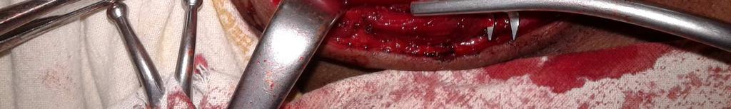 carotid artery