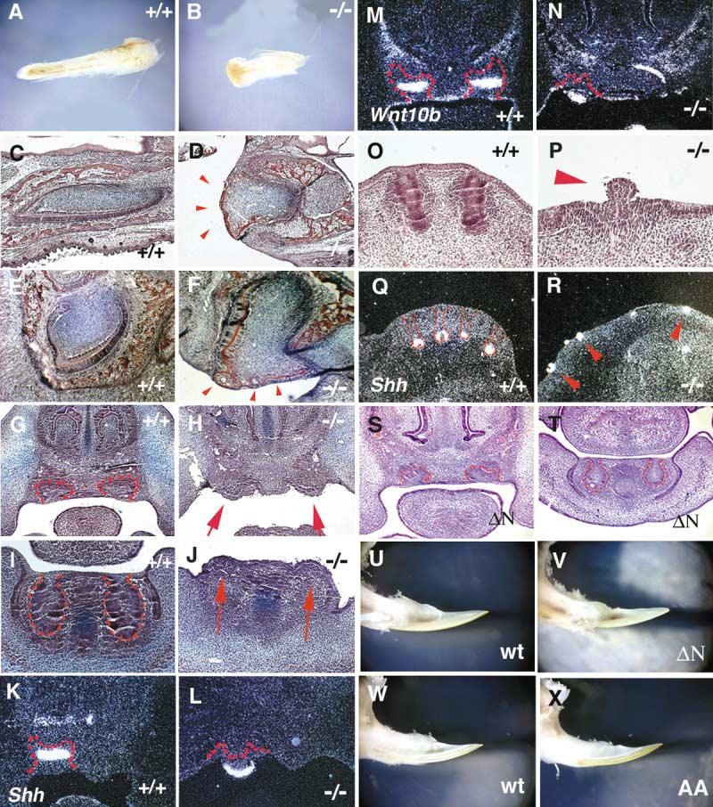 A Dual Role for Ikk in Tooth Development 223 Figure 5. The Incisor Tooth and Whisker Phenotypes of Wild-Type, Ikk /, c I B N, and Ikk AA/AA Mice Incisors at E13 (G J), E13.