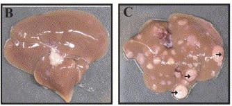 HCC is increased in DEN Treated Mice Deficient in Hepatocyte IKKß