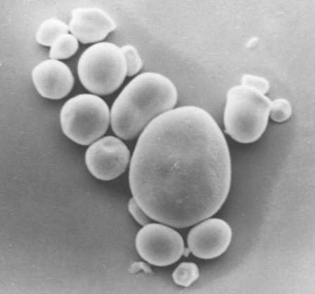 Fig. Fig.5 6 5 6 Chloroplast Starch Mitochondria Glycogen granules 0.