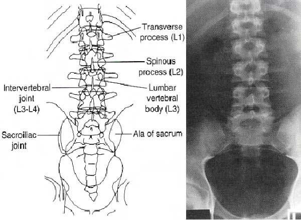 Section III. PROJECTIONS OF THE LUMBAR SPINE 4-8.