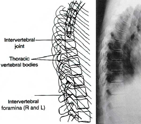 4-2. THE LATERAL THORACIC
